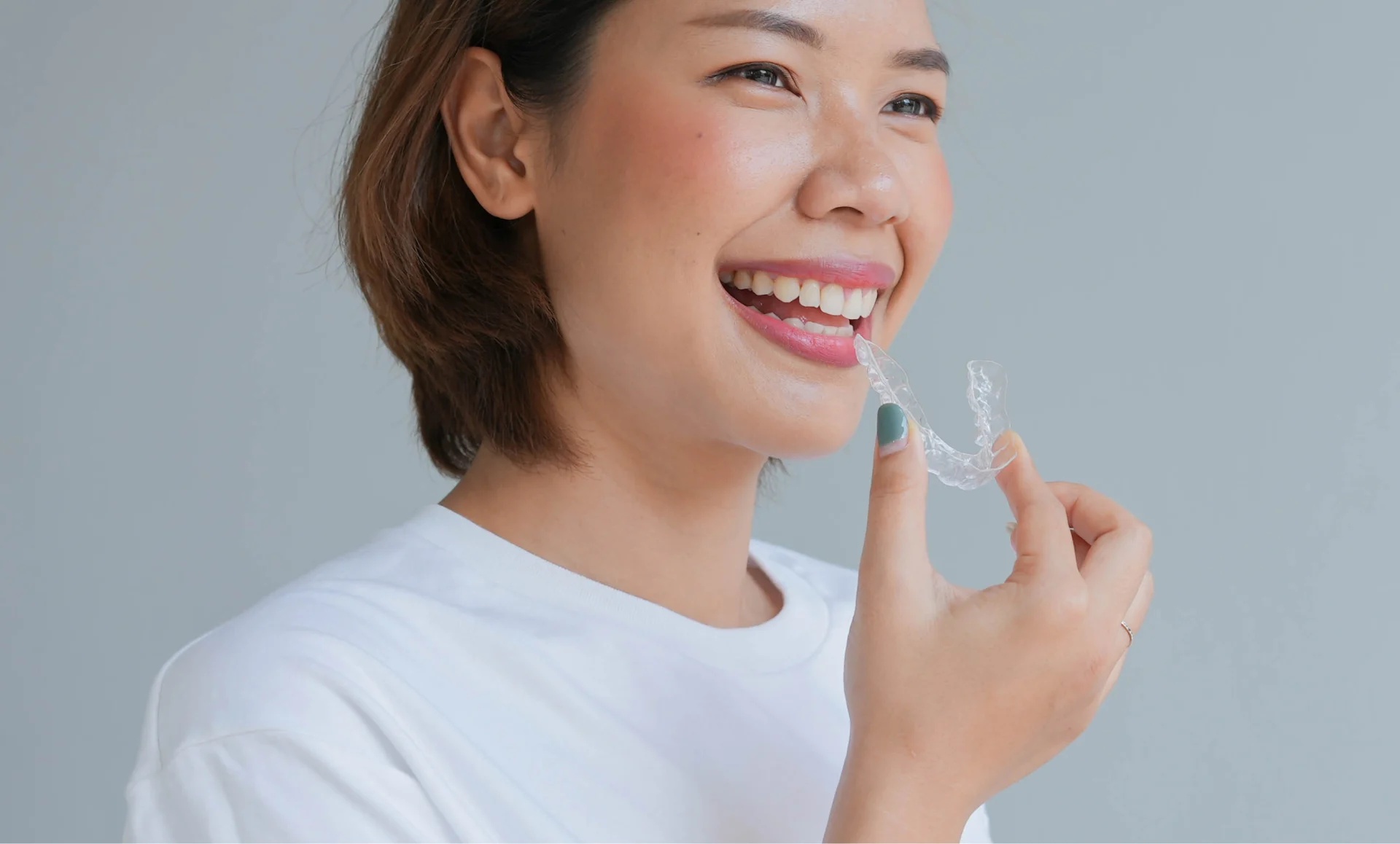 Invisalign